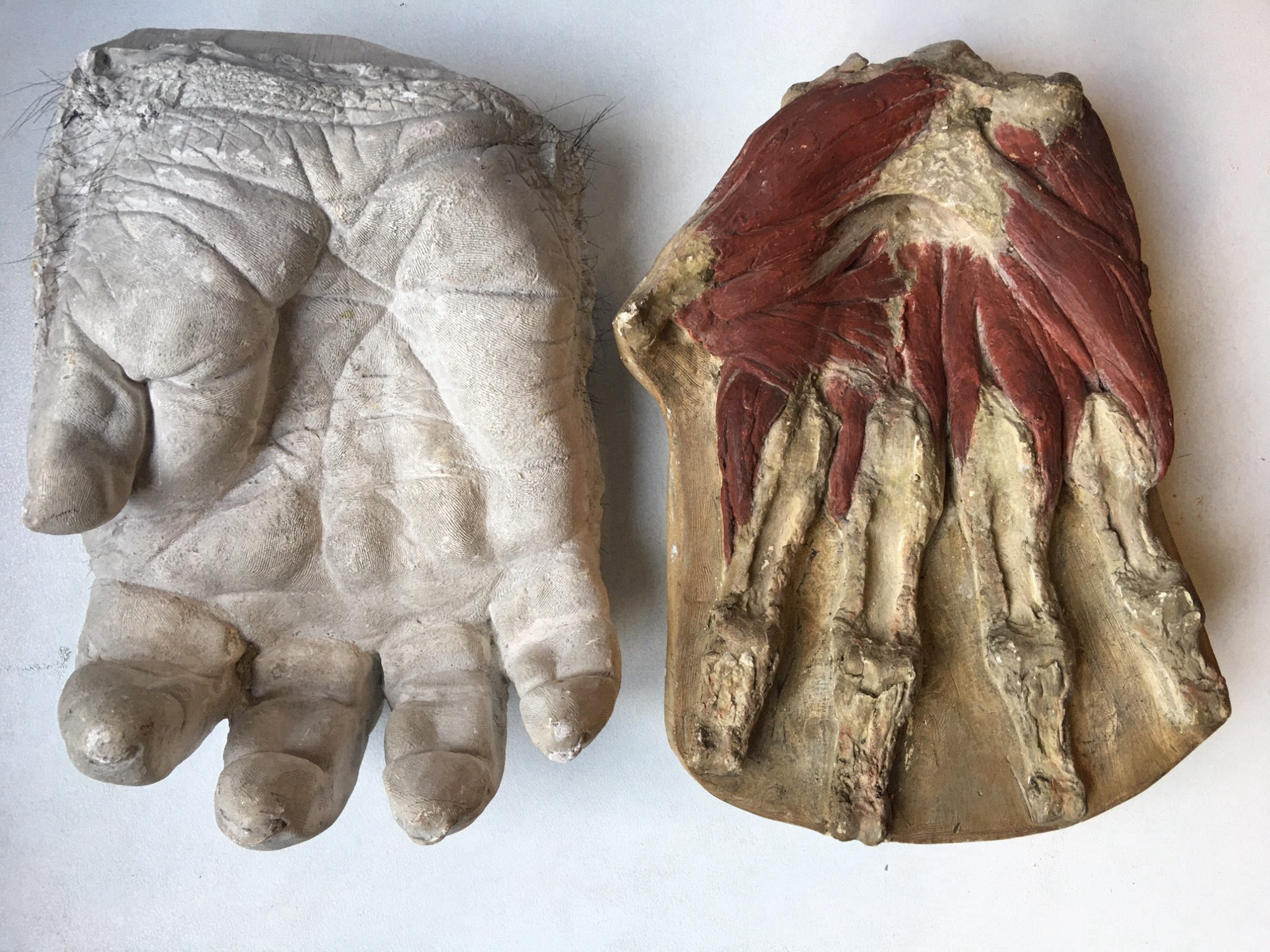 Two plaster casts of "Bobby" the gorilla's hand from above. The muscles in the left cast have been exposed and coloured. Next to it is a white plaster cast of the hand.