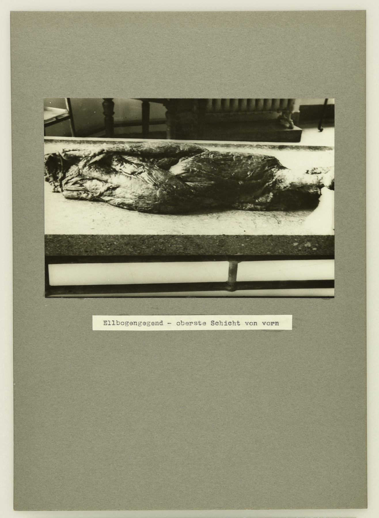 Black-and-white close-up of a piece of tissue on a stretcher in a room; in the background part of a heater is visible. It is a piece of "Bobby" the gorilla's arm that has been removed from his body and now has its muscles exposed. The photo has been stuck to a piece of grey cardboard and bears a typewritten caption: "Elbow – top layer from the front"